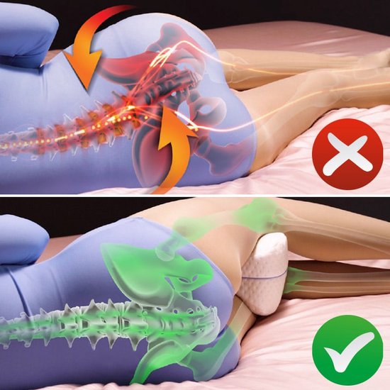 Dreamolino Beinkissen | Ergonomisches Knie- und Beinkissen | Hochwertiger Memory-Schaum | Sorgt für optimalen Liegekomfort für Seitenschläfer | Für mehr Komfort | Orthopädisches Kniekissen