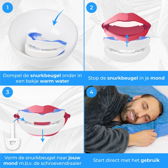 Nuvance - Anti Schnarch Spange Pro - Verstellbar - Inkl. eBook - Schnarchspange - Schnarchgebiss - Schnarchen