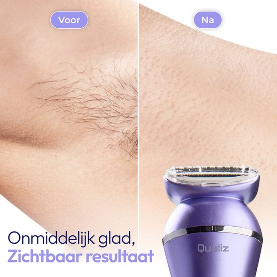 7-in-1-Ladyshaver – Epiliergerät für Damen – IPX 7 wasserdicht – Wiederaufladbar – Bikini-Trimmer – Intimrasierer für Damen – Ladyshaver für Frauen – Epilierer – Trimmer für Damen – Qualiz®