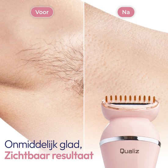 7-in-1-Ladyshaver – Epiliergerät für Damen – IPX 7 wasserdicht – Wiederaufladbar – Bikini-Trimmer – Intimrasierer für Damen – Ladyshaver für Frauen – Epilierer – Trimmer für Damen – Qualiz®