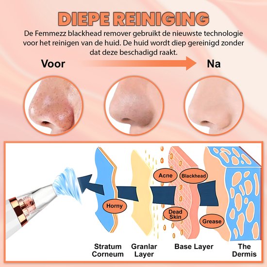 TibaGoods Premium Mitesserentferner I Porenreiniger mit 6 Aufsätzen Mitesser entfernen | Akne | Komedonenlöffel | Hautpflege