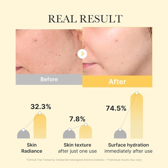 Medicube Kojic Acid & Turmeric Brightening Gel-Maske