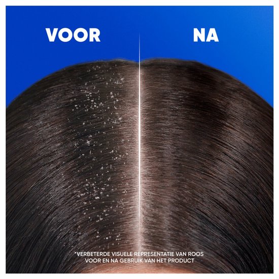 Head & Shoulders – Shampoo – Classic – 300 ml