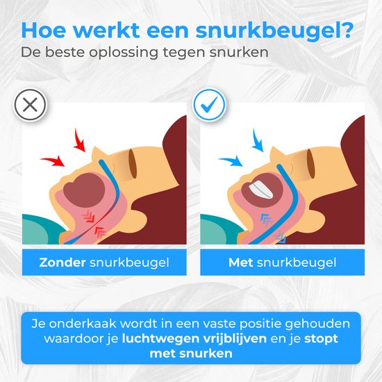 Nuvance - Anti Schnarch Spange Pro - Verstellbar - Inkl. eBook - Schnarchspange - Schnarchgebiss - Schnarchen