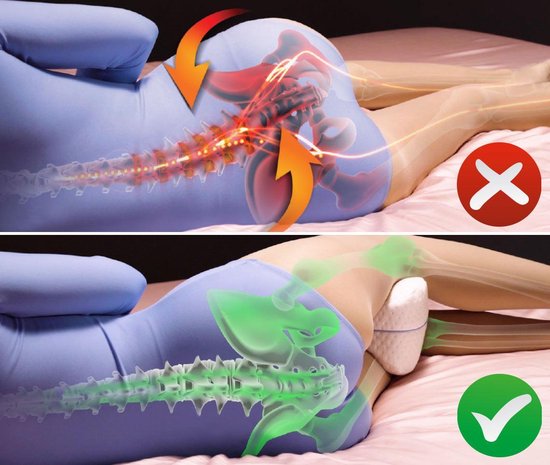 Dreamolino Beinkissen | Ergonomisches Knie- und Beinkissen | Hochwertiger Memory-Schaum | Sorgt für optimalen Liegekomfort für Seitenschläfer | Für mehr Komfort | Orthopädisches Kniekissen