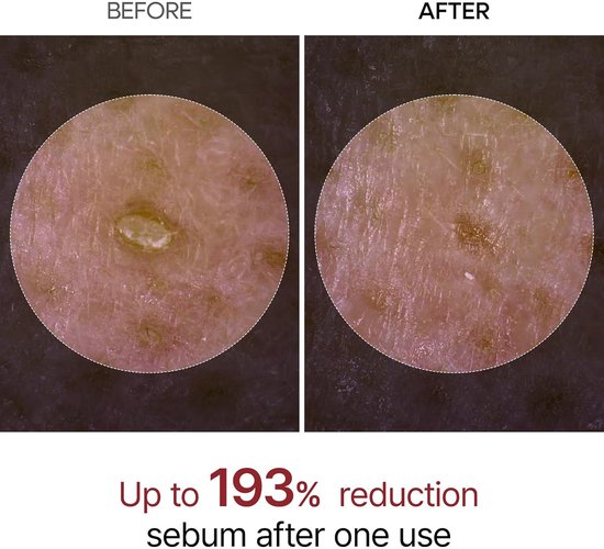 Dr. Melaxin – Peel Shot Exfoliant Ampulle mit weißem Reis – 80 ml