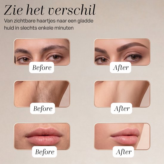 Sansbeauté 3-in-1-Epilierer für Frauen PocketPRO mit Reisetasche – Epiliergerät für Damen – Epilierer – Gesichts-Epilierer für Frauen – Gesichtsenthaarung für Damen – Epilierer für das Gesicht – Epilierer für Damen – Gesichts-Epilierer für Damen – Wiedera
