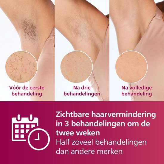 Philips Lumea IPL 7000 Serie – IPL-Haarentfernungsgerät – 2 Aufsätze mit Trimmer – BRI921/00