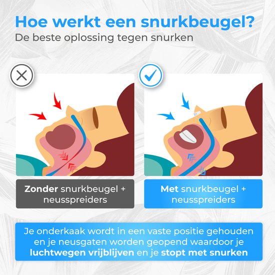 Nuvance - Anti Schnarch Set - Anti Schnarch Spange - Nasenspreizer - Nasenklammer - Schnarchspange - Inkl. eBook - Schnarchen stoppen - besser schlafen