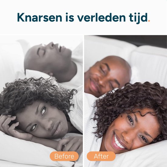 Nachtspange - Zähneknirschendes Gebiss - Zähneknirschendes Gebiss für Erwachsene - Gebiss - Zähneknirschen