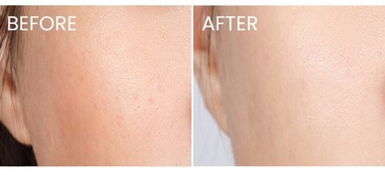 La Mer The Night Recovery Concentrate Cream – 7 ml