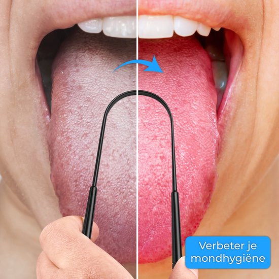 Nuvance Professioneller Zungenschaber – 3-in-1-Set – für die Mundpflege – Zungenreiniger – Zungenschaber – Tongue Scraper – Edelstahl – Schwarz