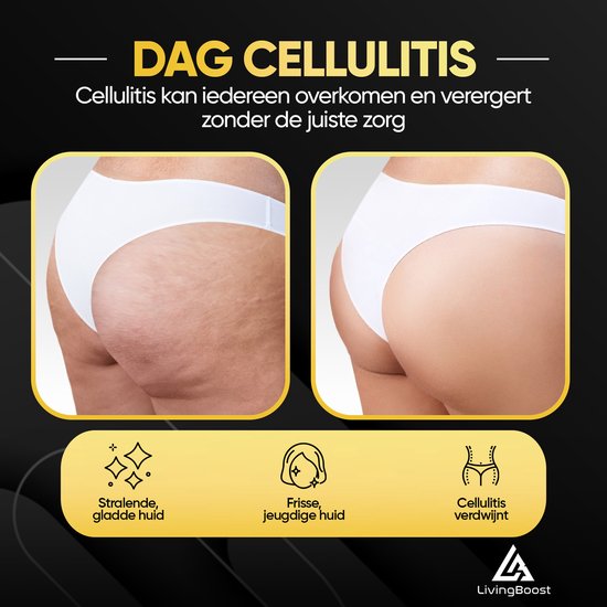 LivingBoost® Elektrisches Cellulite-Massagegerät - Inklusive Gua Sha - 12 Stufen und Temperaturen - Ganzkörper - Schröpfkopf-Set Massage - Anti Cellulite