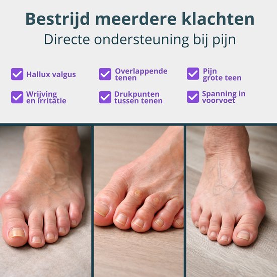 VeryGoods™ Hallux Valgus Zehenkorrektor - Zehenspreizer Großzehe - 2 Stück - Zehenschutz - Hammerzehe - Zehenspreizer