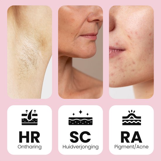 Leafline® IPL Laser Epilierer - Epilierer Damen - Schmerzfrei mit Eiskühlung - Für dauerhafte Haarentfernung von allen Körperteilen - 999.999 Blitze - Heimgebrauch