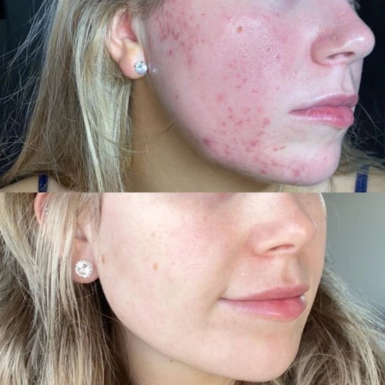 Eco By Sonya - Serum von Clear organisch & natürlich 30 ml
