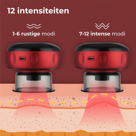 Nuvance - Elektrisches Cellulite-Massagegerät - 12 Stufen und Temperaturen - Inkl. eBook - Ganzkörper - Schröpfkopf-Set Massage - Cellulite-Schröpfköpfe - Hijama-Schröpfköpfe - Anti Cellulite