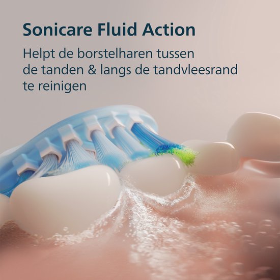 Philips Sonicare DiamondClean 9000 – Elektrische Zahnbürste – Rosa/Weiß – Ombre – HX9911/84