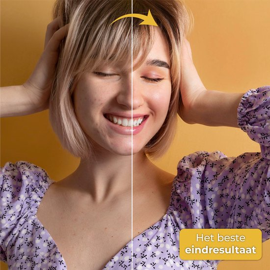 Nuvance - Dermaroller - 540 Mikronadeln von 0,5mm - Inkl. eBook - Derma Roller für die Hautpflege - Bartroller für Haarwuchs - Steril verpackt