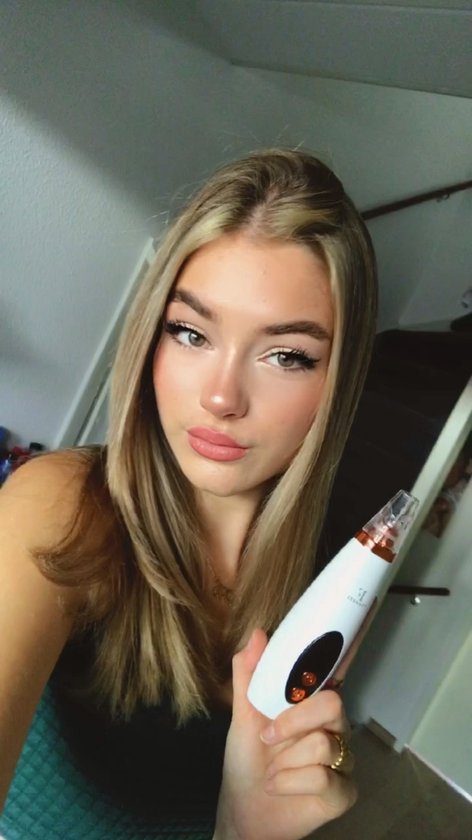 TibaGoods Premium Mitesserentferner - Porenreiniger mit 6 Aufsätzen Mitesser entfernen - Akne - Komedonenlöffel - Hautpflege