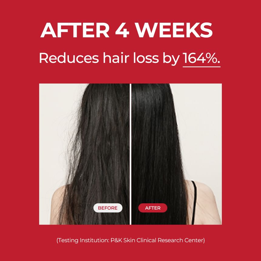 MOEV Annurcatin Hair Tonic 150ml - Spendet Feuchtigkeit & stärkt das Haar - frischer Apfelduft