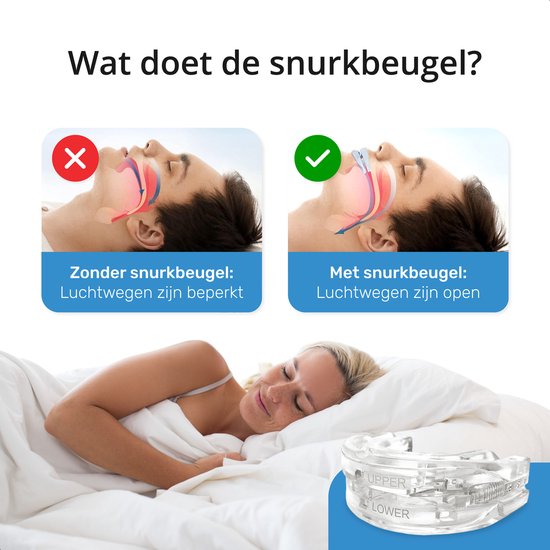 Airmaster Anti Snore Brace - Einstellbar - Schlafprodukte - Nasenspreizer - Gebissschutz - Schnarchen - Gebiss - Transparent BPA frei