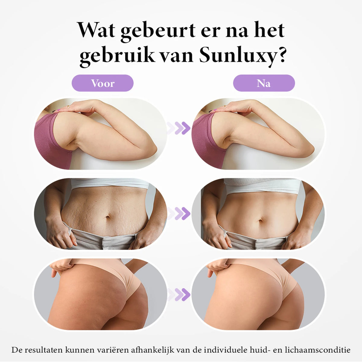Sunluxy BCE1 Anti-Cellulite-Massagegerät – EMS + Vakuum + Rotlicht – 3 Stufen für Körper und Gesicht – Wiederaufladbar – 19,4 x 17 x 7,8 cm