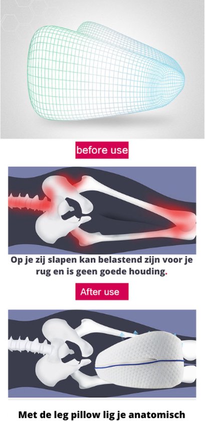 Dreamolino Beinkissen | Ergonomisches Knie- und Beinkissen | Hochwertiger Memory-Schaum | Sorgt für optimalen Liegekomfort für Seitenschläfer | Für mehr Komfort | Orthopädisches Kniekissen