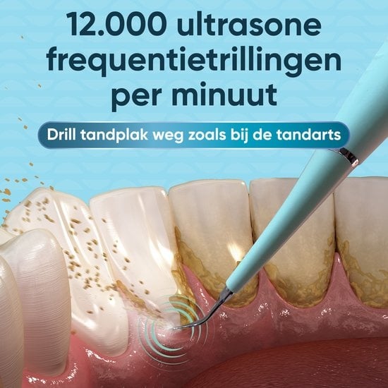 Elektrischer Zahnsteinentferner - Zähne polieren - Zahnsteinentferner - Elektrische Plaque-Entfernung