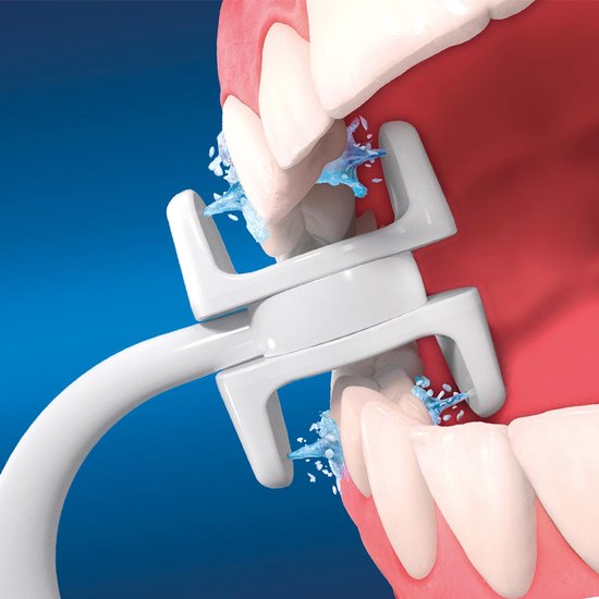 CorpCare MiracleSmile Elektrische Munddusche – Wiederaufladbar, einstellbarer Wasserdruck, H-förmiger Reiniger, kompakt und wasserdicht, ideal für empfindliches Zahnfleisch