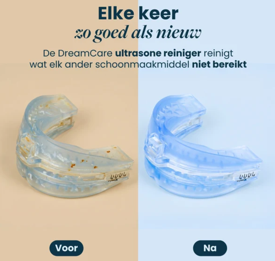 DreamCare UltraPod – Ultraschallreiniger – Weiß – 5 Zeitstufen, reinigt in 60 Sekunden